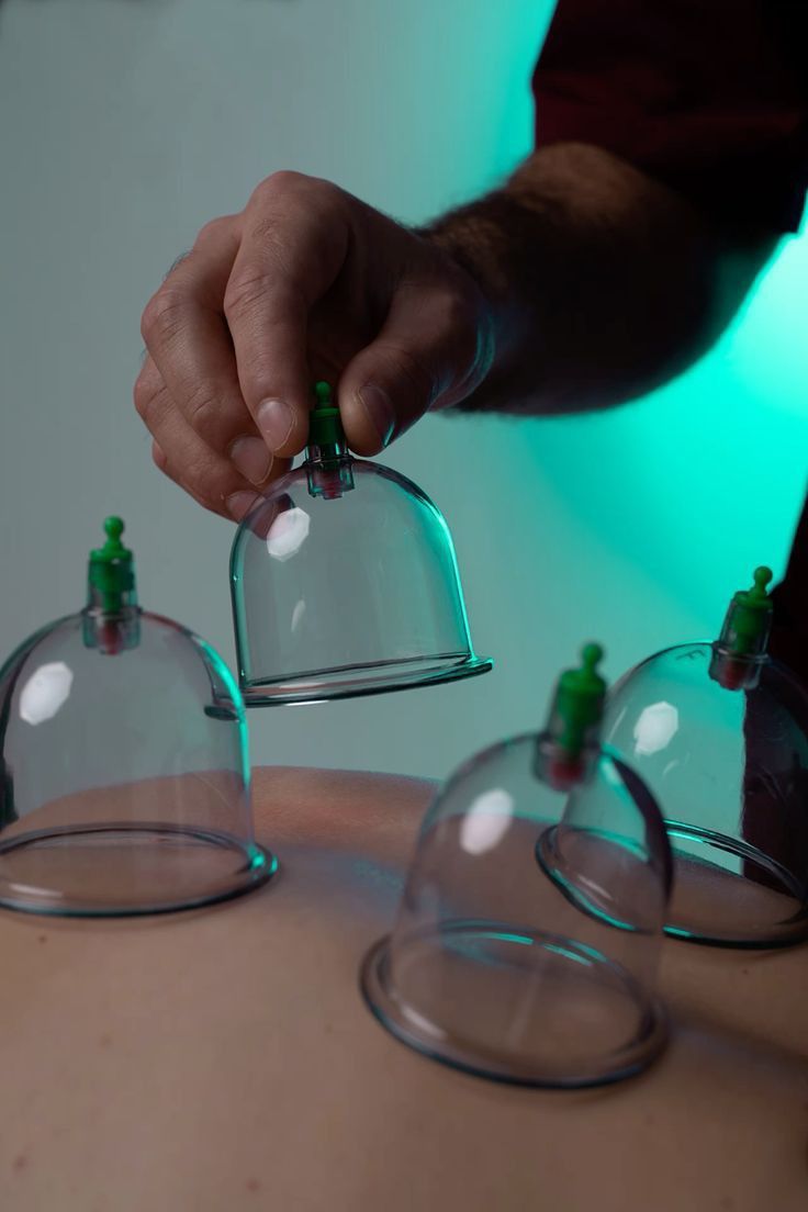 Cupping